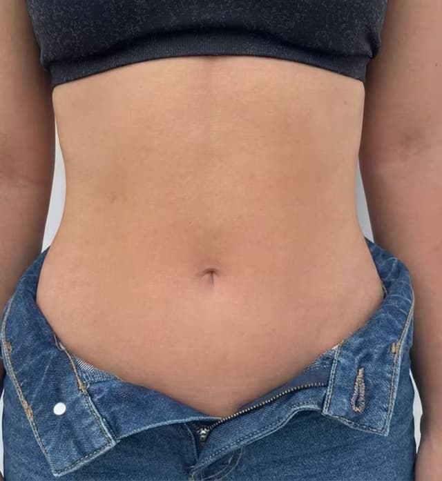 Abdomen relajado
