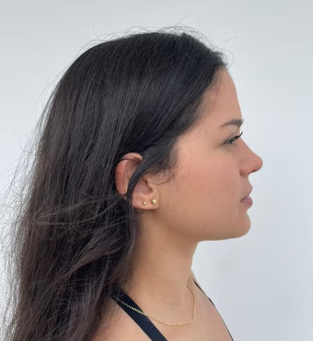 Cara lateral derecha