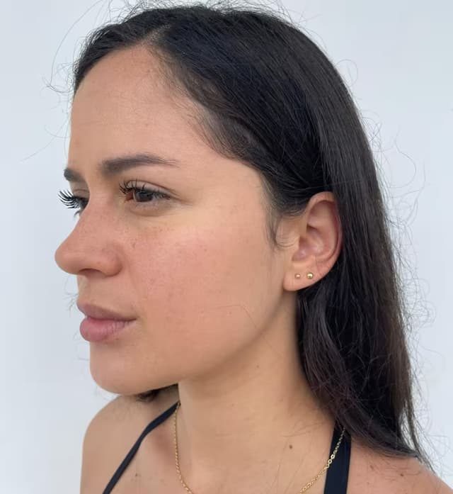 Cara lateral izquierda